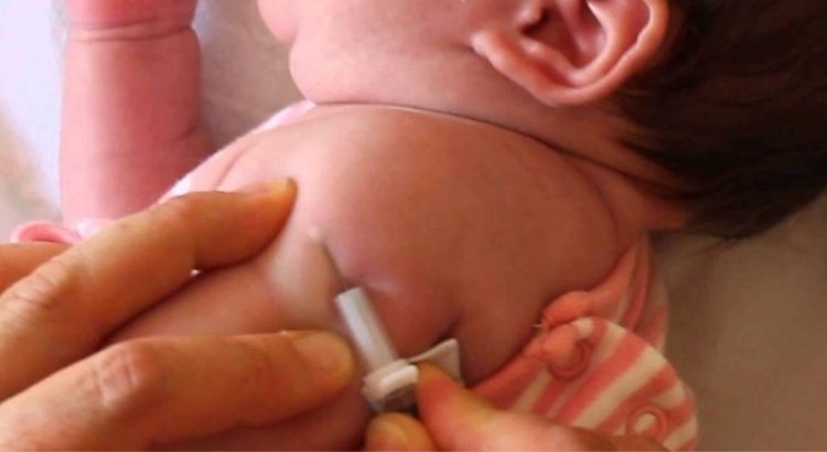 Denuncia falta de vacuna contra tuberculosis en Navojoa